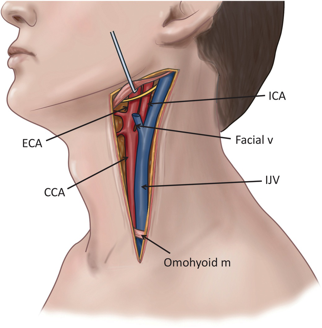 Not in the front you won t the jugular veins pictured 206734691